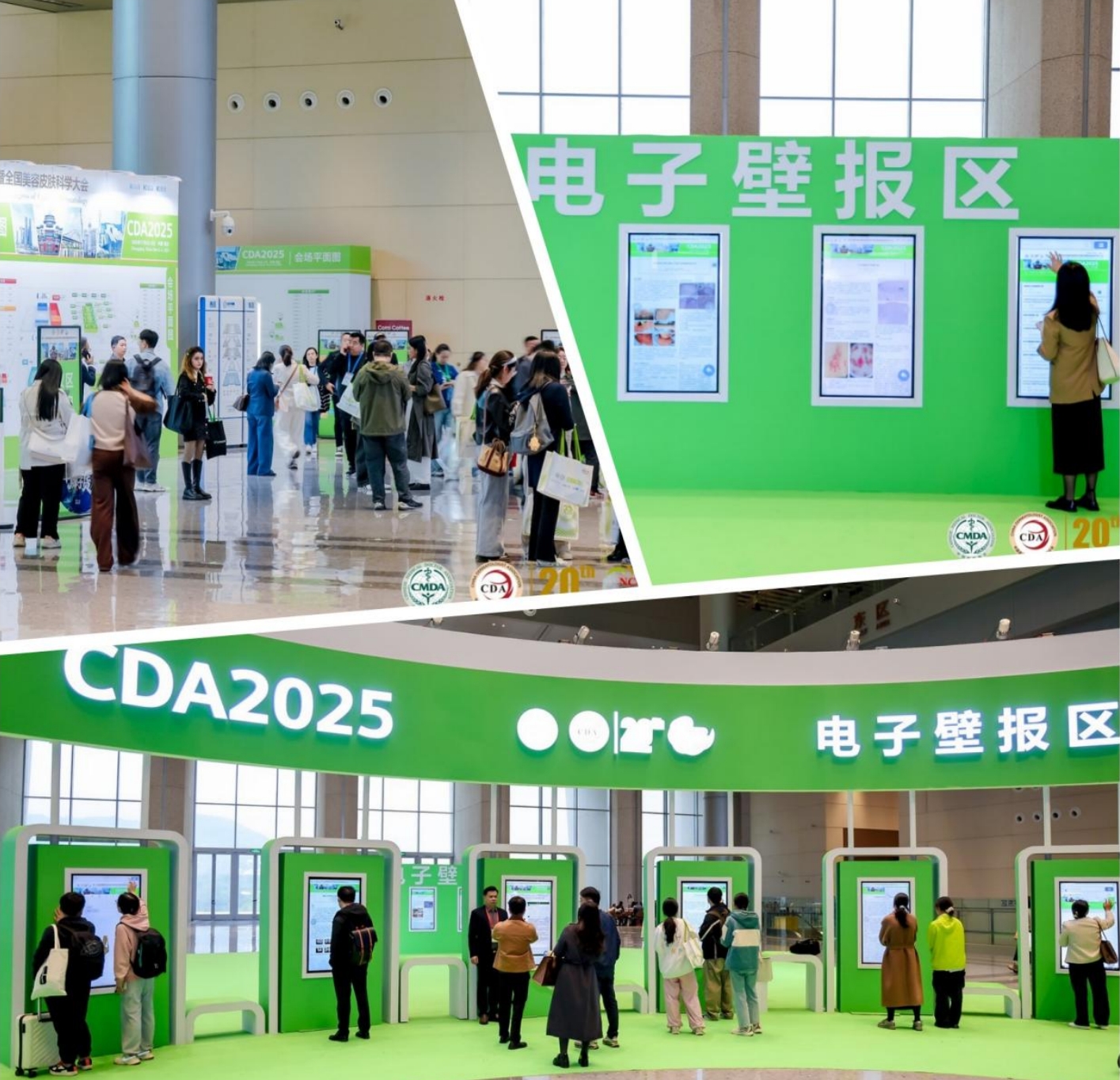 告别瘢痕疙瘩！综合疗法突破复发难题