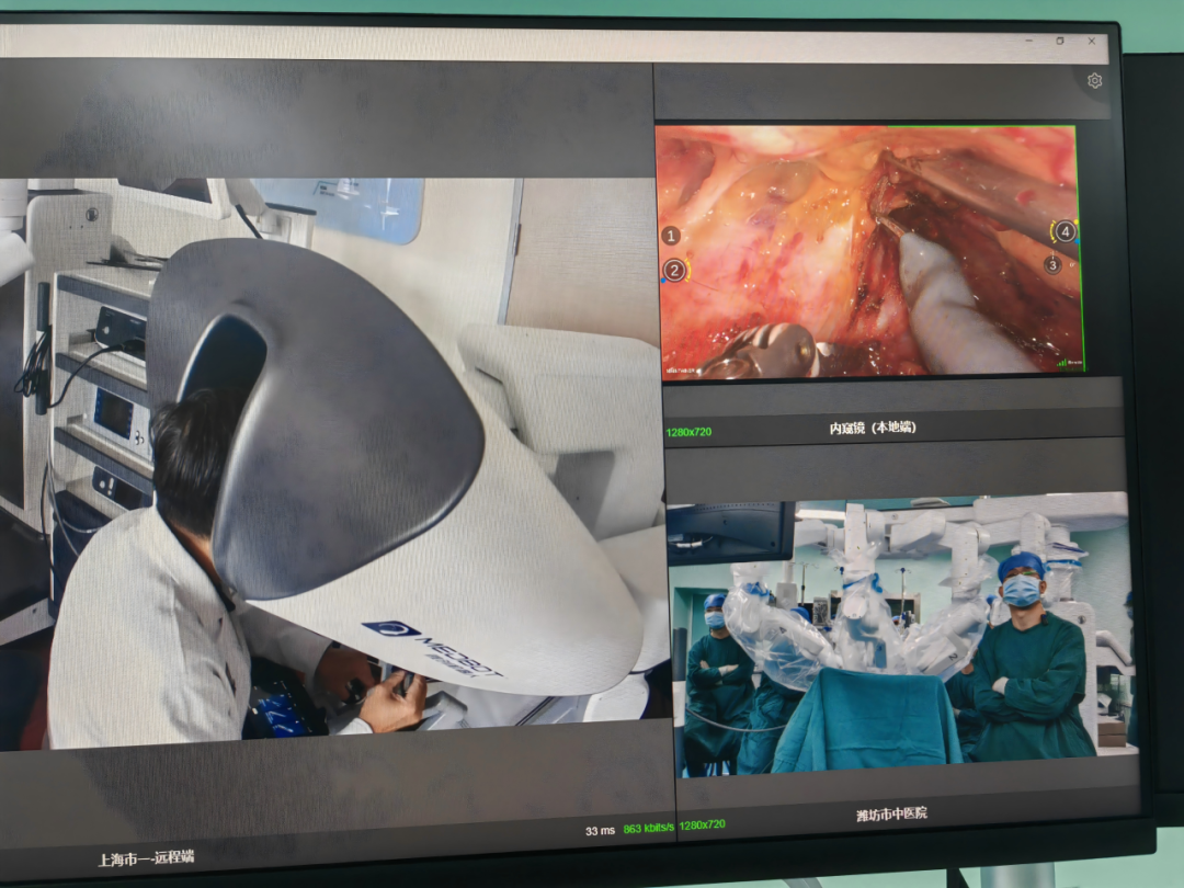 千里眼+万能手,首例鲁沪远程机器人手术成功完成
