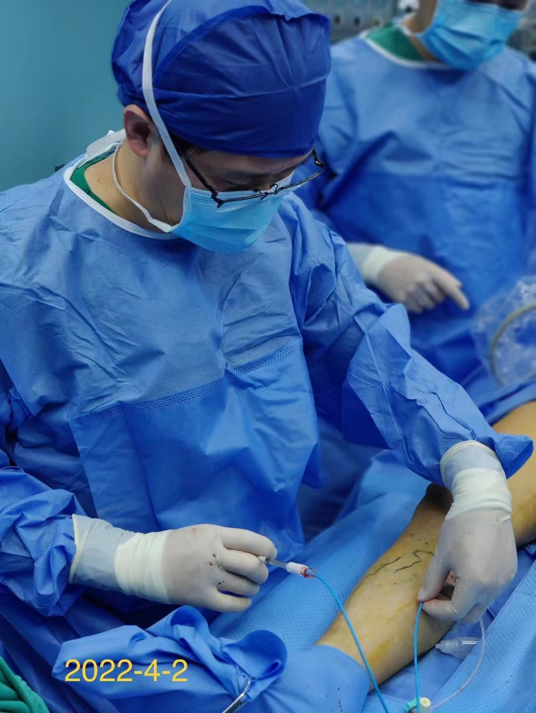 “聊着天就治好了老毛病”全国首例静脉胶临床应用成功